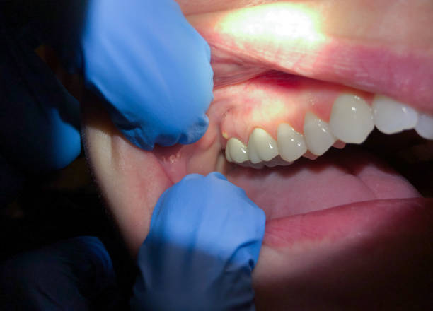 Best 24-Hour Emergency Dentist in White Sulphur Springs, WV