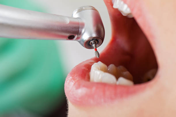 Professional Emergency Dentist in WV